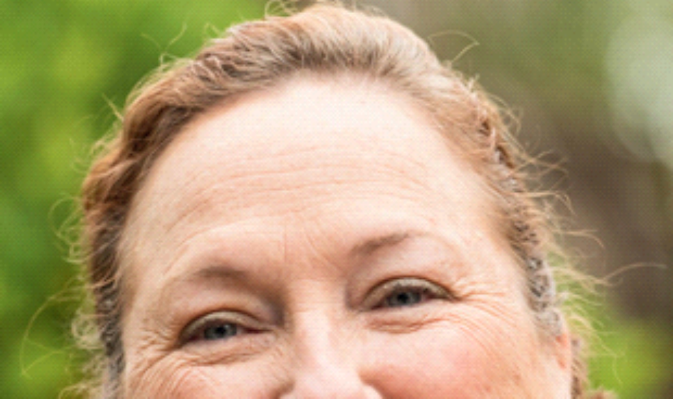 Gambar Kulit Dehidrasi